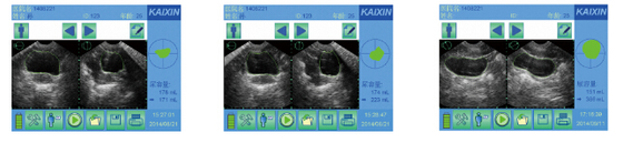 BVT01 Bladder scanner