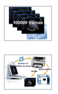 DCU12 portable full digital color doppler ultrasound scanner