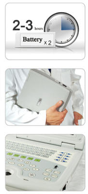 KX5000 laptop ultrasound scanner for human
