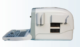 KX2000G portable B mode human ultrasound scanner