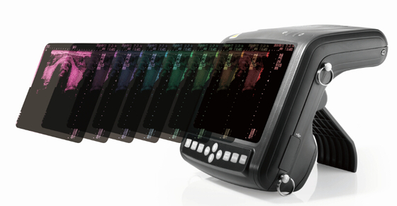 KX5200 wrist human ultrasound scanner