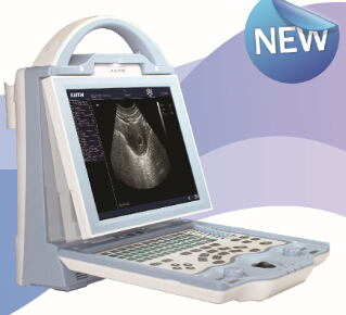 KX5600 portable human ultrasound scanner