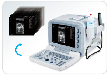 KX2000V portable full digital B mode veterinary ultrasound scanner