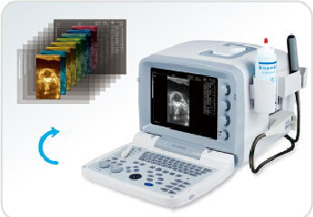 KX2000V portable full digital B mode veterinary ultrasound scanner