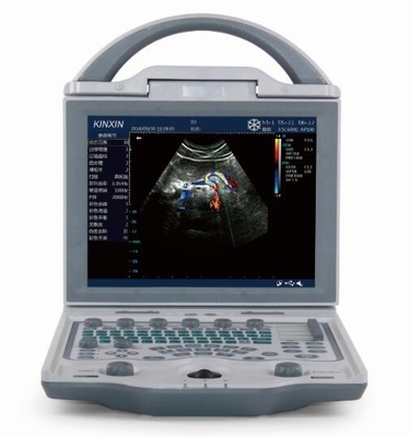 DCU12 portable full digital color doppler ultrasound scanner(Updated version)