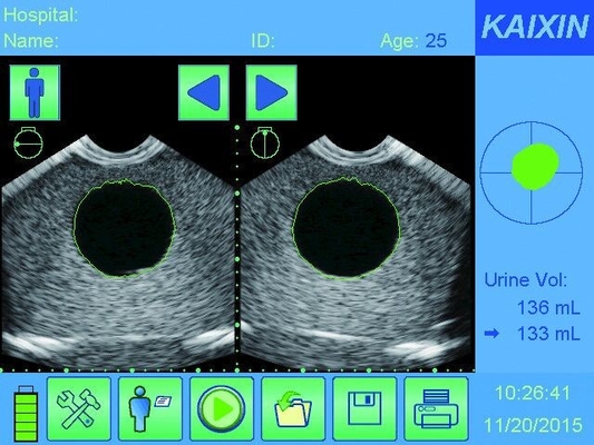 BVT01 Bladder scanner