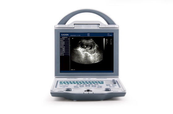 KX5600 Full digital B mode ultrasonic diagnostic instruments