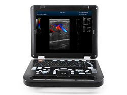 DCU30 Full Digital Color Doppler Ultrasonic Diagnostic Instruments