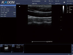 DCU10 Instrument de diagnostic ultrasonore Doppler couleur numérique
